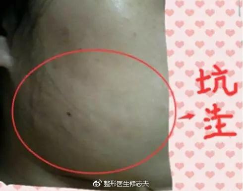 凹凸不平