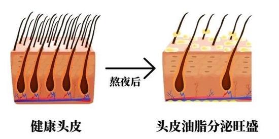cr:视觉中国,制图于canva,下同