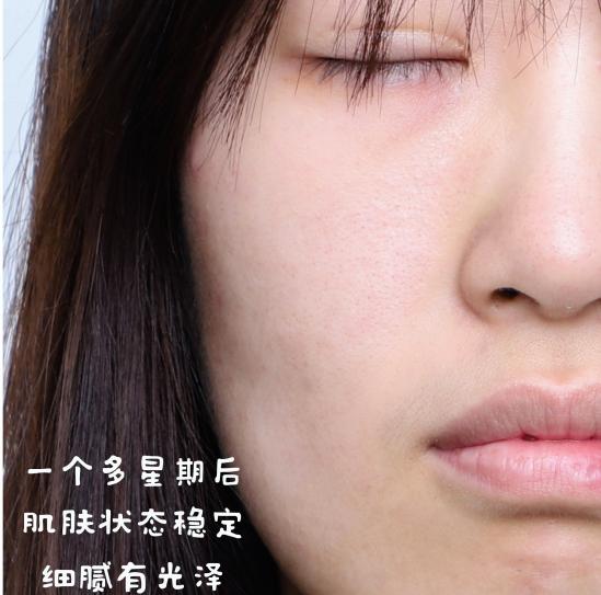 字体素材canva