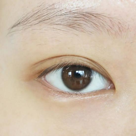 使用后(使用效果因人而异)