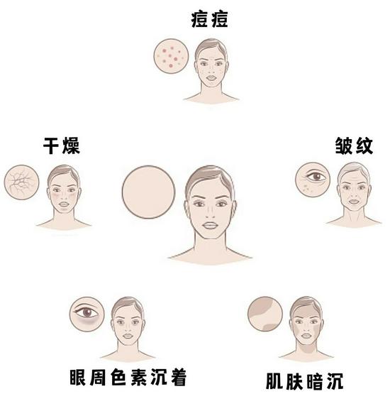 cr:视觉中国,制图canva