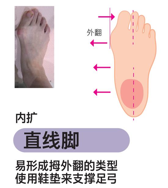 缺乏运动人群必看！正确的步行方式可以增加肌肉