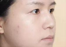 (图为上粉底液前后对比)