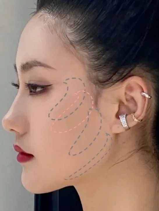 图源:小红书@630923221