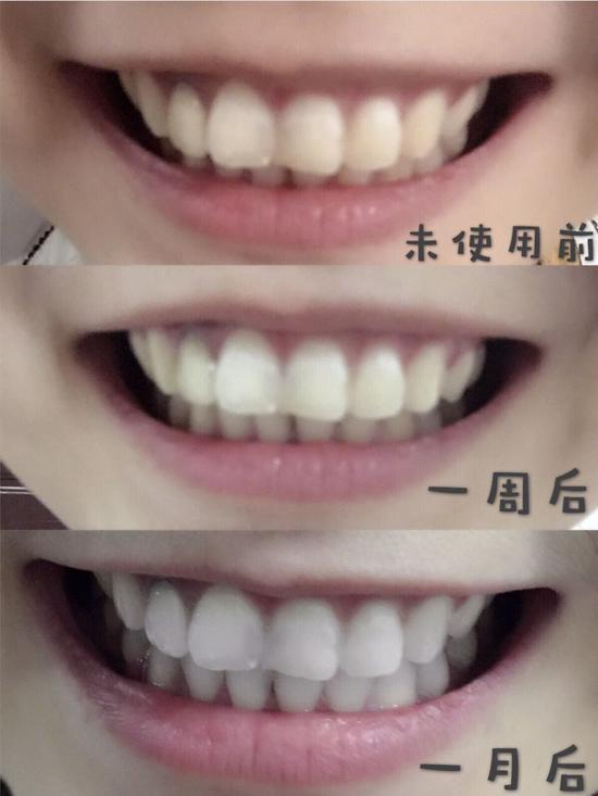 图源小红书@妙脆角是我