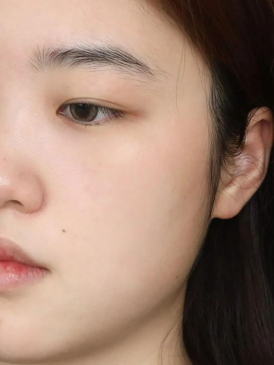 使用后(使用效果因人而异)