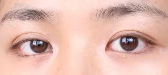 使用后