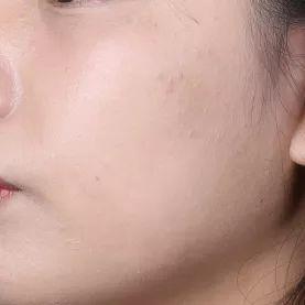 持妆8h后