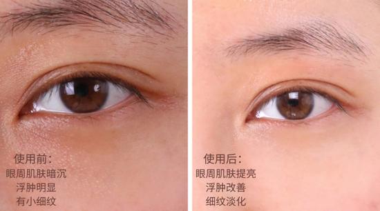 *使用效果因人而异