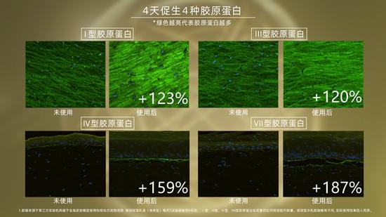 图片数据来源于第三方实验机构基于全层皮肤模型试用怡丽丝尔优悦活颜 弹润保湿乳液(清爽型)每天一次连续使用4天后,I型、III型、IV型、VII型胶原蛋白生成对比对照组提升数量。滋润型水乳数据略有不同,实际使用效果因人而异。