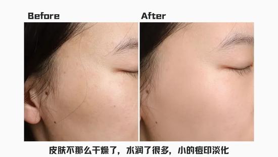 *使用效果因人而异