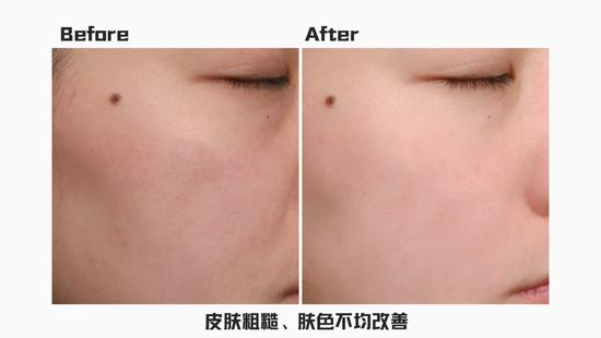 *使用效果因人而异