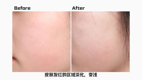 *使用效果因人而异