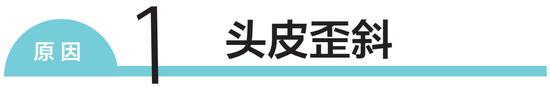 解决毛发弯曲和松软发质 按摩头皮+重视油分护理