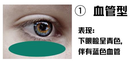 制图于canva,下同