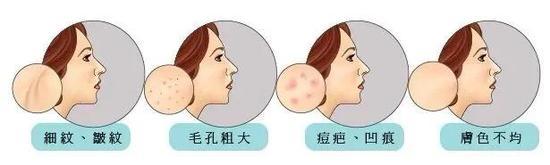 皮肤问题春季相继前来问候