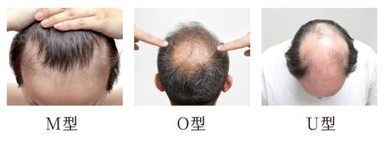 图12来源视觉中国,图3来源canva