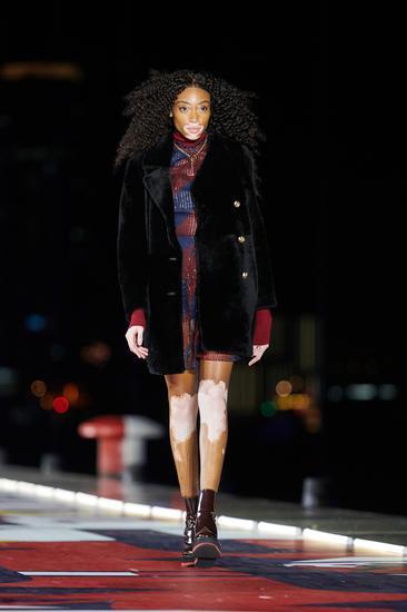 Winnie Harlow