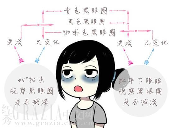 分清你是哪种型的黑眼圈,“对色下药”改善眼部问题!