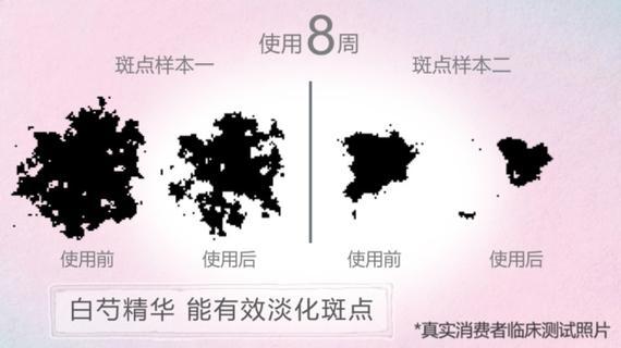 白芍精华能有效淡化斑点