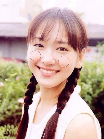 苹果肌到底是什么