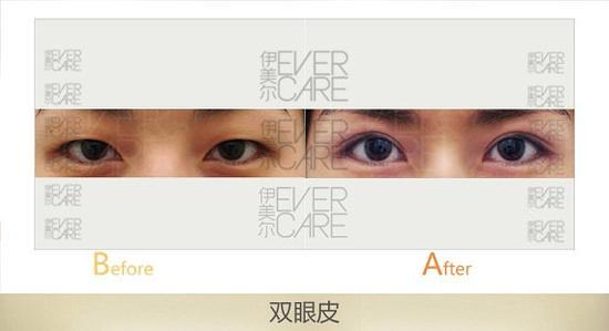 案例展示