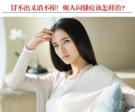 冒不出又消不掉 烦人“闷骚痘”该怎样治