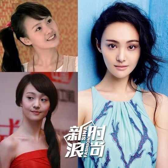 郑爽曾经承认整容