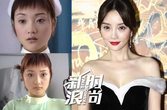 李小璐的鼻子看上去也比过去更挺拔了