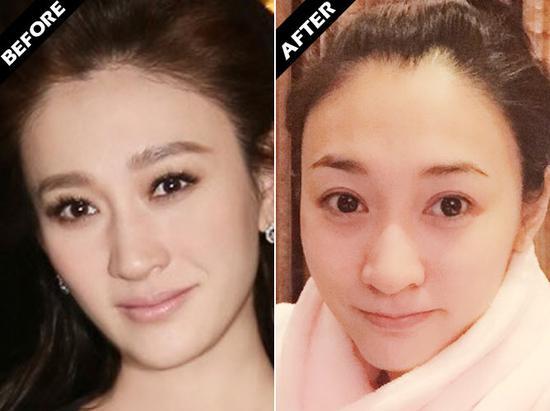 提起水嫩亮白肌不能少了李小冉