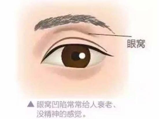 眼窝深陷
