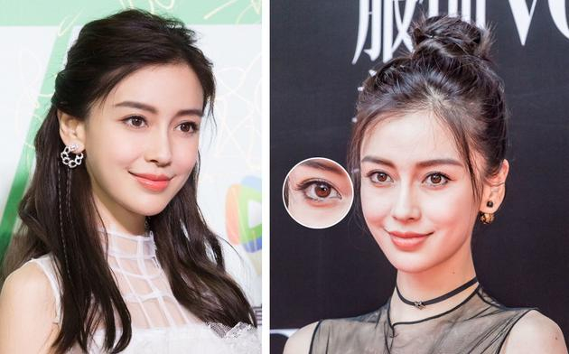 baby的黑眼圈
