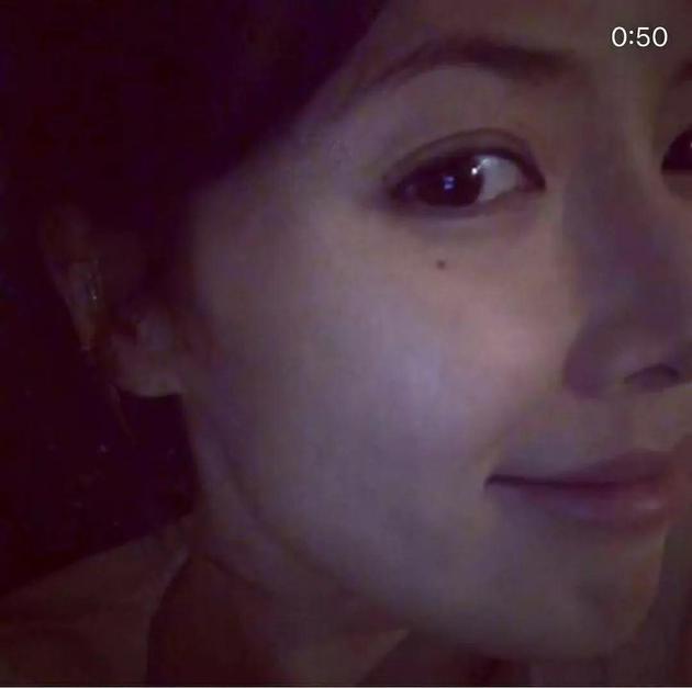 嘴唇的部分看起来也少了很多肿胀感