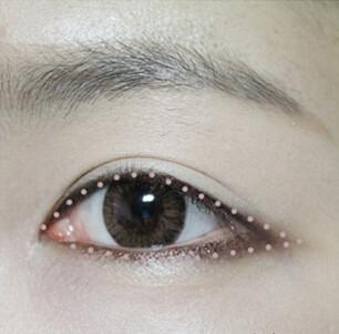STEP2