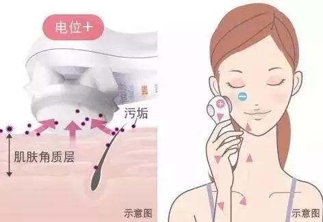 离子洁面仪