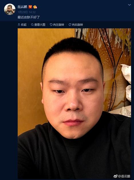 岳云鹏自曝肌肤不好