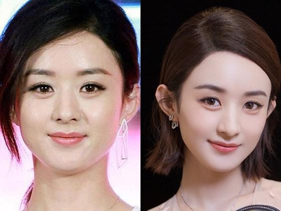 以前赵丽颖的咬合肌比较大加上短下巴,所以显得脸部没有线条
