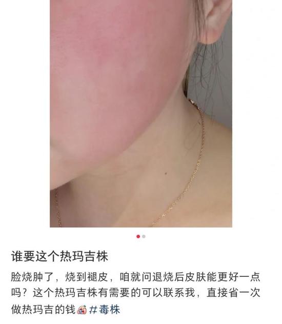 阳康后的新氧女孩，就快还不起贷款了