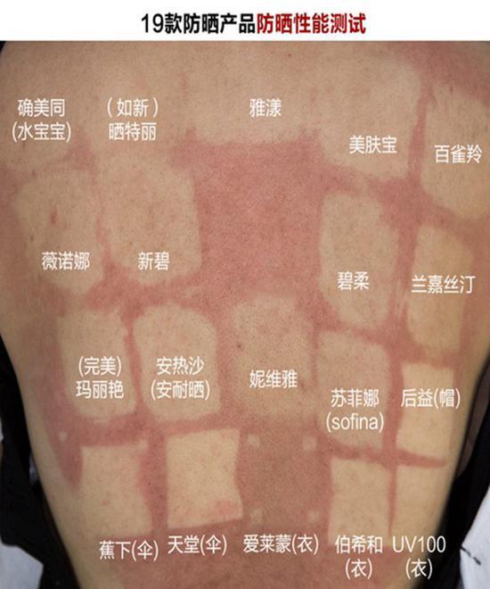 三名志愿者的防晒效果对比