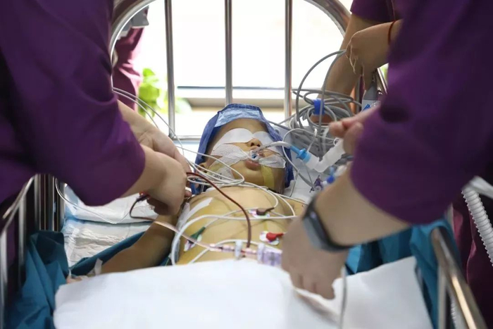 日照心脏病医院成功为3岁先天性心脏病儿童手术