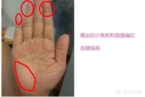手掌发红，是身体哪里发出来的信号？