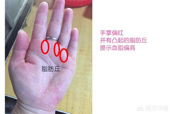 手掌发红，是身体哪里发出来的信号？