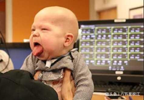 男婴患巨舌症舌头回不到嘴里,200万手术费愁坏父母!