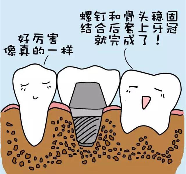 牙龈常常肿胀、流血，当心植牙周围疾病