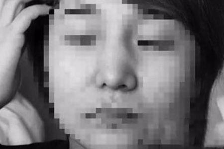 整容手术有哪些风险，女子整容包揽13个项目，术后就后悔了