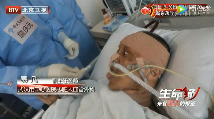 这两位武汉大夫，被人工肺ecmo救回了生命，脸黑，伤痕累累……
