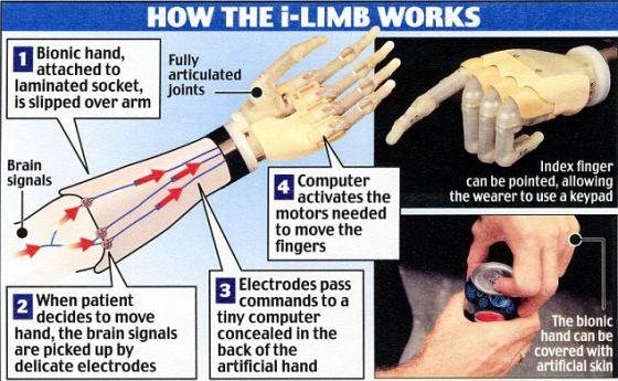 假手“i-Limb”的构造及工作原理 假手“i-Limb”的构造及工作原理