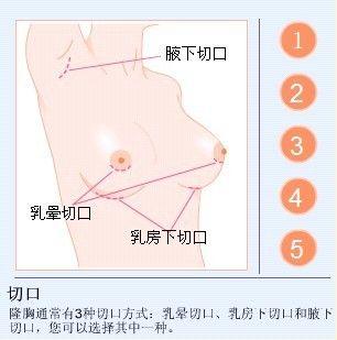 切口 切口