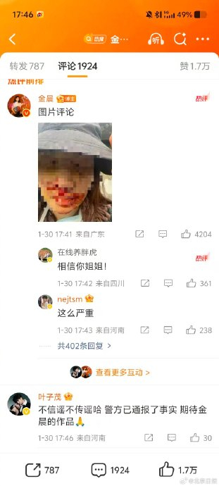 女星金晨发布车祸受伤照片