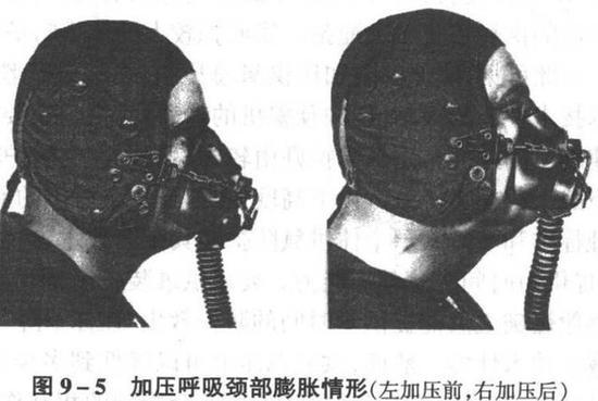 图:加压呼吸